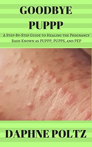 Read online Goodbye PUPPP: A Step-by-Step Guide to Healing the Pregnancy Rash Known as PUPPP, PUPPS, and PEP - Daphne Poltz | PDF